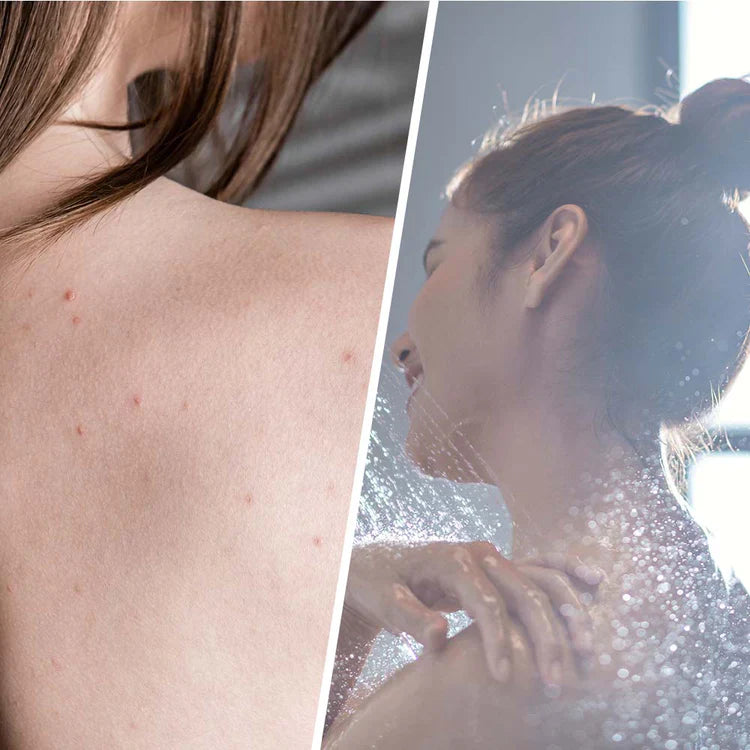 Scrub salicilico con albero da tè per disintossicazione della pelle 250 ml