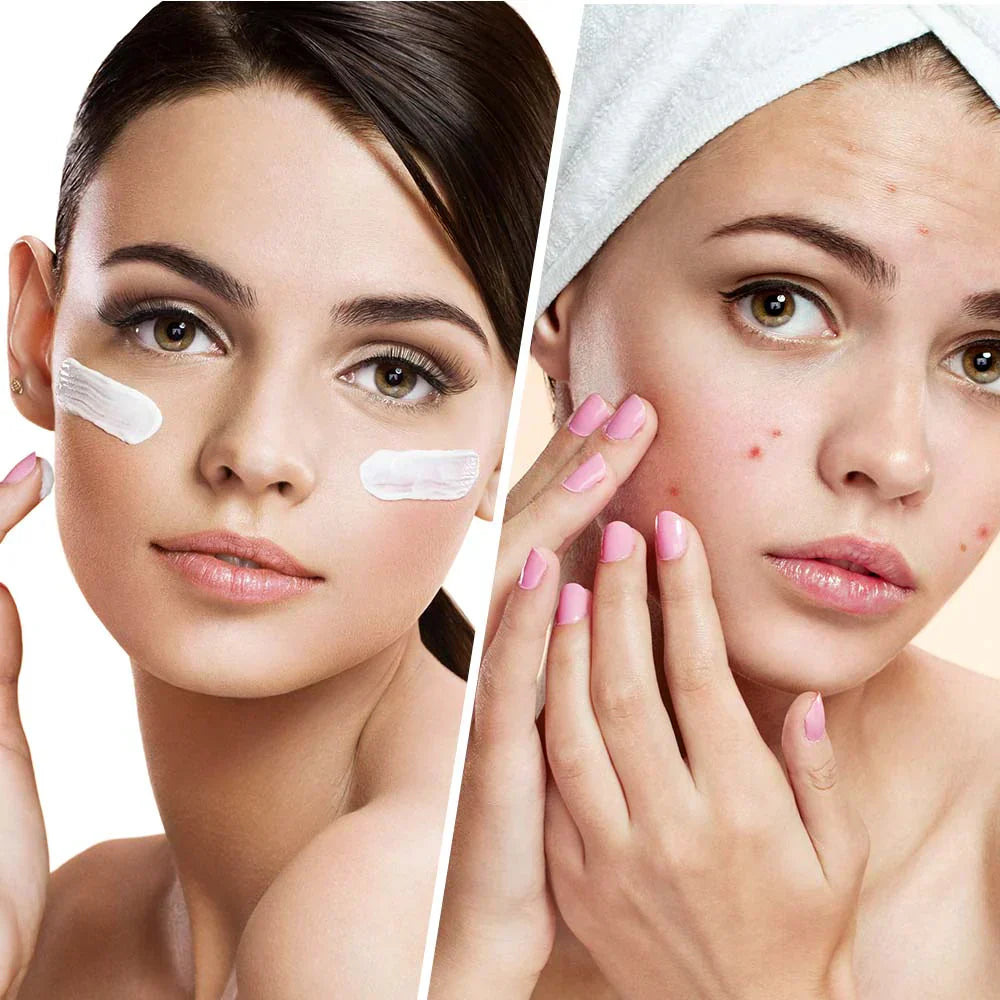 Clear Balance – Crema viso idratante contro brufoli e imperfezioni con niacinamide 50 ml