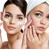 Clear Balance – Crema viso idratante contro brufoli e imperfezioni con niacinamide 50 ml